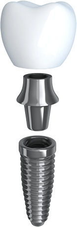 Part of a complete dental implant
